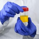 Laboratory doctor with a can of urine tests in his hands on a white background.