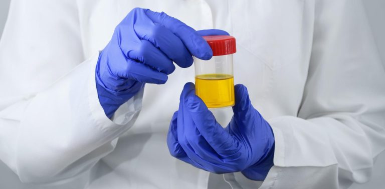 Laboratory doctor with a can of urine tests in his hands on a white background.